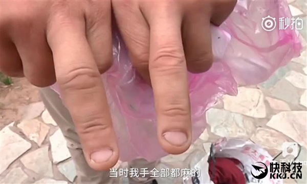 内地首炸！新买iPhone7疑爆炸成两半 果粉被毁容